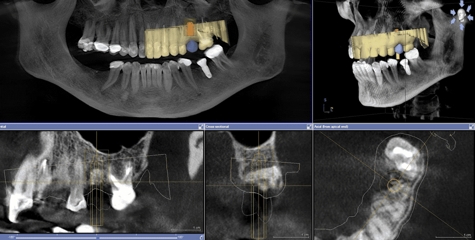 dental-cone-beam-computed