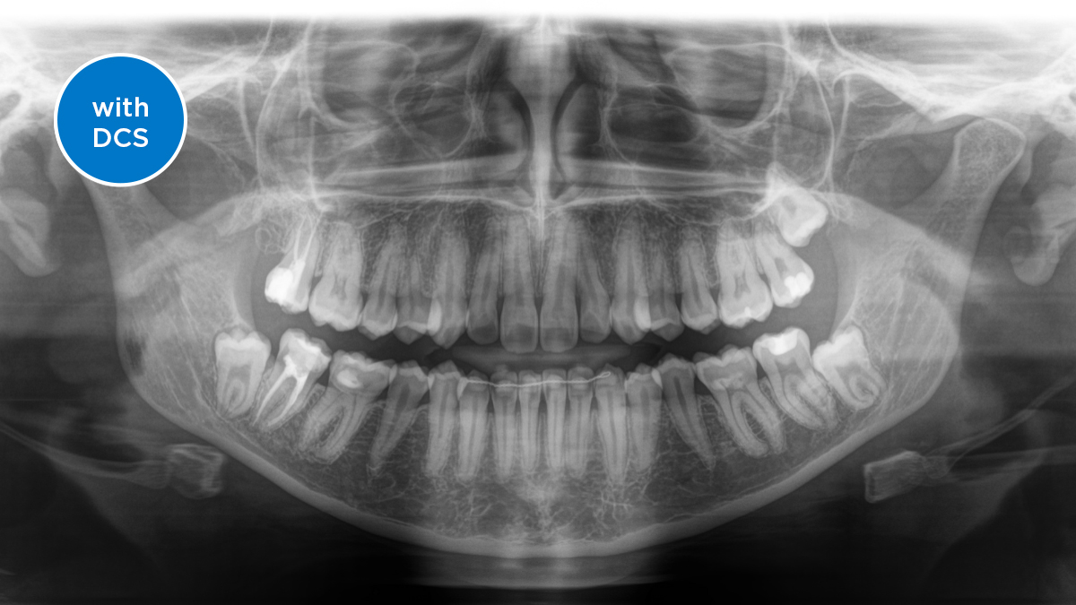 img-image-comparison-extraoral-dcs-with-dcs-1-2